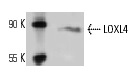 LOXL4 (N-14): sc-48731. Western blot analysis of LOXL4 expression in HOS whole cell lysate.