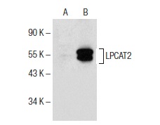 LPCAT2 (C-14): sc-164904. Western blot analysis of LPCAT2 expression in non-transfected: sc-117752 (A) and human LPCAT2 transfected: sc-177480 (B) 293T whole cell lysates.