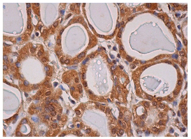 LPCAT2 (C-14): sc-164904. Immunoperoxidase staining of formalin fixed, paraffin-embedded human thyroid gland tissue showing cytoplasmic and nuclear staining of glandular cells.