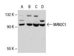 MAN2C1 (C-17): sc-66458. Western blot analysis of MAN2C1 expression in Hep G2 (A), Jurkat (B), BJAB (C) and NIH/3T3 (D) whole cell lysates.