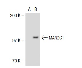 MAN2C1 (V-20): sc-66461. Western blot analysis of MAN2C1 expression in non-transfected: sc-117752 (A) and human MAN2C1 transfected: sc-116217 (B) 293T whole cell lysates.