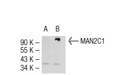 MAN2C1 (V-20): sc-66461. Western blot analysis of MAN2C1 expression in non-transfected: sc-117752 (A) and mouse MAN2C1 transfected: sc-121498 (B) 293T whole cell lysates.