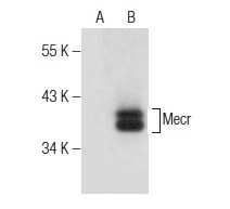 Mecr (G-12): sc-160510. Western blot analysis of Mecr expression in non-transfected: sc-117752 (A) and mouse Mecr transfected: sc-125592 (B) 293T whole cell lysates.