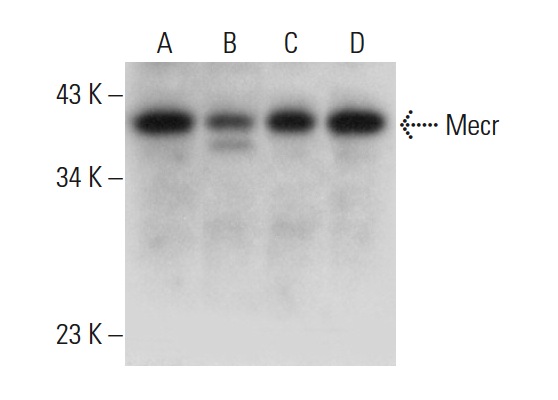 Mecr (G-12): sc-160510. Western blot analysis of Mecr expression in K-562 (A), HeLa (B), HL-60 (C) and Jurkat (D) whole cell lysates.