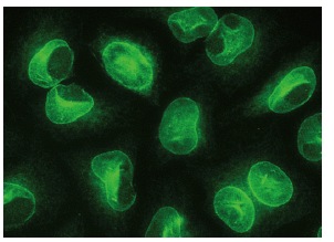 FRP-3 (H-170): sc-13941. Immunofluorescence staining of methanol-fixed HeLa cells showing nuclear membrane localization.