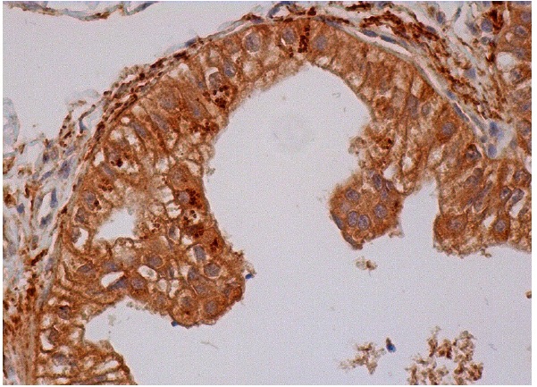 MMP-2 (K-20)-R: sc-8835-R. Immunoperoxidase staining of formalin fixed, paraffin-embedded human epididymis tissue showing membrane and cytoplasmic staining of glandular cells.