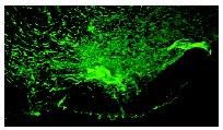 MMP-2 (K-20): sc-8835. Immunofluorescence staining of formalin-fixed, paraffin-embedded canine digital flexor tendon, twenty-one days after injury. Note staining in areas of active remodeling and scar formation. Kindly provided by Dr. Timothy Ritty from Washington University School of Medicine.
