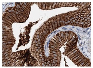 N-SMase2 (H-195): sc-67305. Immunoperoxidase staining of formalin fixed, paraffin-embedded human gall bladder tissue showing membrane and cytoplasmic staining of glandular cells at high magnification. Kindly provided by The Swedish Human Protein Atlas (HPA) program.