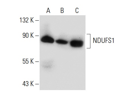 NDUFS1 (E-8): sc-271510. Western blot analysis of NDUFS1 expression in Raji (A), HeLa (B) and SK-MEL-28 (C) whole cell lysates.