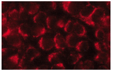NDUFS1 (E-8): sc-271510. Immunofluorescence staining of methanol-fixed HeLa cells showing cytoplasmic localization.