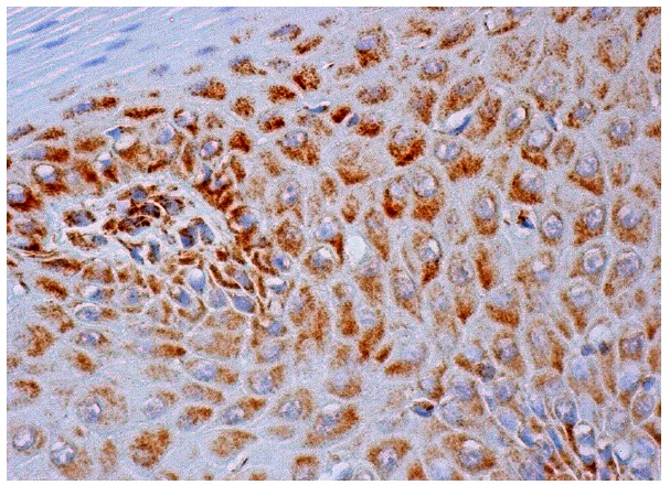 NDUFS1 (E-8): sc-271510. Immunoperoxidase staining of formalin fixed, paraffin-embedded human oral mucosa tissue showing cytoplasmic staining of squamous epithelial cells.