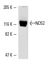 NOS2 (C-11): sc-7271. Western blot analysis of NOS2 expression in LPS and IFN-γ-treated RAW 264.7 whole cell lysate.