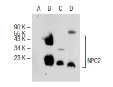 NPC2 (D-3): sc-166449. Western blot analysis of NPC2 expression in non-transfected 293T: sc-117752 (A), mouse NPC2 transfected 293T: sc-122108 (B), Hep G2 (C) and human PBL (D) whole cell lysates.