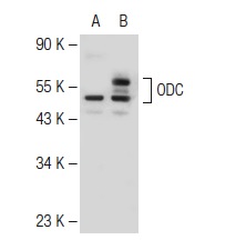 ODC (N-15): sc-21515. Western blot analysis of ODC expression in non-transfected: sc-117752 (A) and human ODC transfected: sc-170296 (B) 293T whole cell lysates.