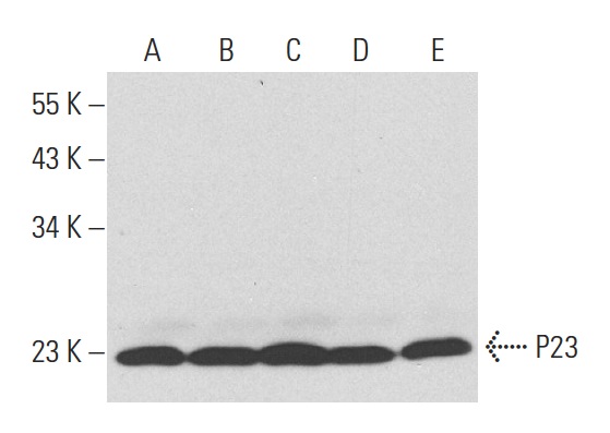 P23 (JJ6): sc-101496. Western blot analysis of P23 expression in A549 (A), HeLa (B), HS treated HeLa (C), NIH/3T3 (D) and HS treated NIH/3T3 (E) whole cell lysates.