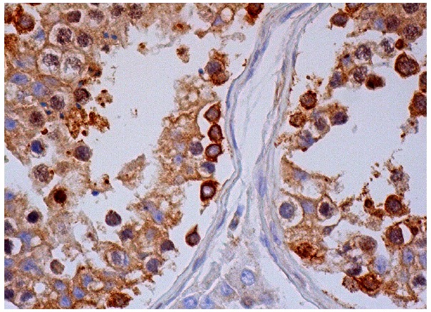 P23 (JJ6): sc-101496. Immunoperoxidase staining of formalin fixed, paraffin-embedded human testis tissue showing cytoplasmic, membrane and nuclear staining of cells in seminiferous ducts.