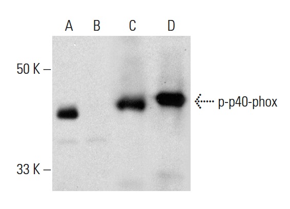 Western blot analysis of p40-phox phosphorylation in untreated (A,C) and lambda protein phosphatase (sc-200312A) treated (B,D) THP-1 whole cell lysates. Antibodies tested include p-p40-phox (Thr 154): sc-33403 (A,B) and p40-phox (B-1): sc-48376 (C,D).