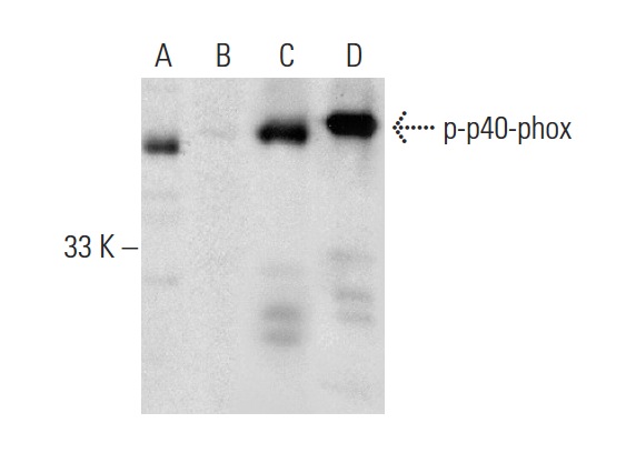 Western blot analysis of p40-phox phosphorylation in untreated (A,C) and lambda protein phosphatase (sc-200312A) treated (B,D) THP-1 whole cell lysates. Antibodies tested include p-p40-phox (B-8): sc-377550 (A,B) and p40-phox (B-1): sc-48376 (C,D).