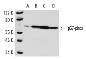 p67-phox (C-19): sc-7662. Western blot analysis of p67-phox expression in whole cell lysates prepared from untreated (A), PMA-induced (B) and DMSO-induced (C) HL-60 cells and THP-1 cells (D).