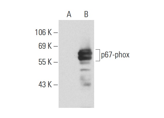 p67-phox (C-19): sc-7662. Western blot analysis of p67-phox expression in non-transfected: sc-117752 (A) and human p67-phox transfected: sc-175244 (B) 293T whole cell lysates.