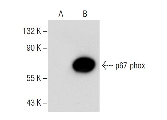 p67-phox (H-300): sc-15342. Western blot analysis of p67-phox expression in non-transfected: sc-117752 (A) and mouse p67-phox transfected: sc-122337 (B) 293T whole cell lysates.