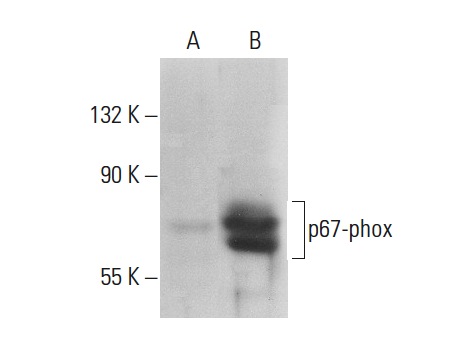 p67-phox (H-300): sc-15342. Western blot analysis of p67-phox expression in non-transfected: sc-117752 (A) and human p67-phox transfected: sc-175244 (B) 293T whole cell lysates.