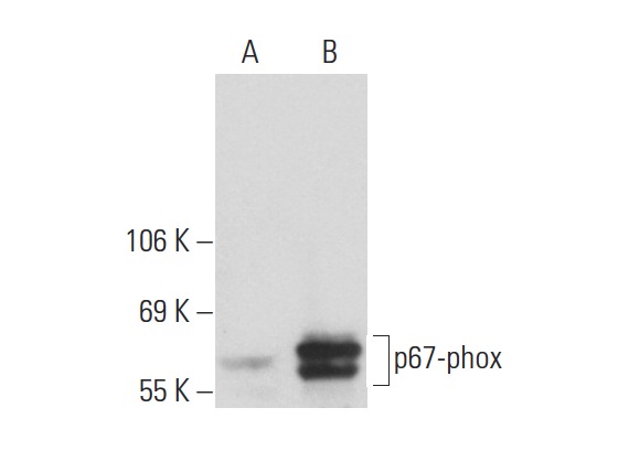p67-phox (H-300): sc-15342. Western blot analysis of p67-phox expression in non-transfected: sc-117752 (A) and human p67-phox transfected: sc-175244 (B) 293T whole cell lysates.