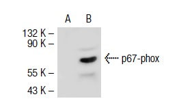 p67-phox (N-19): sc-7663. Western blot analysis of p67-phox expression in non-transfected: sc-117752 (A) and mouse p67-phox transfected: sc-122337 (B) 293T whole cell lysates.