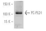 PC-PLD1 (H-160): sc-25512. Western blot analysis of PC-PLD1 expression in Caki-1 whole cell lysate.