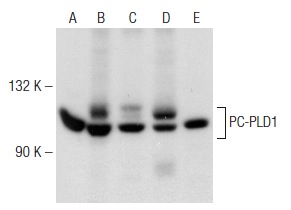 PC-PLD1 (H-160): sc-25512. Western blot analysis of PC-PLD1 expression in PC-12 (A), Caki-1 (B), HL-60 (C), HeLa (D) and U-937 (E) whole cell lysates.