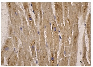 PC-PLD1 (H-160): sc-25512. Immunoperoxidase staining of formalin fixed, paraffin-embedded human heart muscle tissue showing cytoplasmic staining of myocytes.