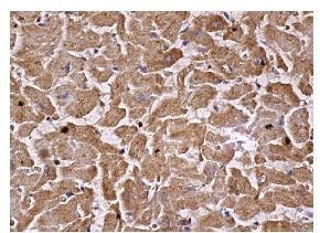gp130 (H-255): sc-9045. Immunoperoxidase staining of formalin fixed, paraffin-embedded human heart muscle tissue showing cytoplasmic staining of myocytes.