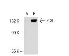 PCB (H-300): sc-67021. Western blot analysis of PCB expression in non-transfected: sc-117752 (A) and mouse PCB transfected: sc-122419 (B) 293T whole cell lysates.