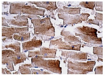 gp130 (AN-H2): sc-9994. Immunoperoxidase staining of formalin fixed, paraffin-embedded human heart muscle tissue showing cytoplasmic staining of myocytes.