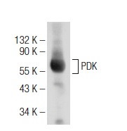 PDK (H-300): sc-28783. Western blot analysis of PDK expression in mouse heart tissue extract.