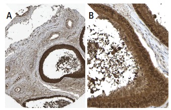 PGD2 synthase (FL-190): sc-30067. Immunoperoxidase staining of formalin fixed, paraffin-embedded human epididymis tissue showing cytoplasmic staining of glandular cells (low and high magnification). Kindly provided by The Swedish Human Protein Atlas (HPA) program.