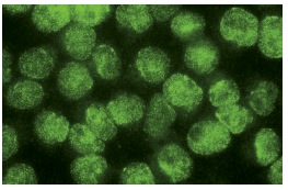 PIG3 (H-300): sc-30068. Immunofluorescence staining of methanol-fixed HeLa cells showing nuclear localization.