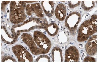 PIG3 (H-300): sc-30068. Immunoperoxidase staining of formalin fixed, paraffin-embedded human kidney tissue showing nuclear and cytoplasmic staining of cells in tubules at high magnification. Kindly provided by The Swedish Human Protein Atlas (HPA) program.