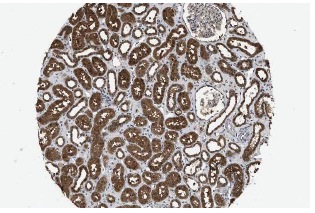 PIG3 (H-300): sc-30068. Immunoperoxidase staining of formalin fixed, paraffin-embedded human kidney tissue showing nuclear and cytoplasmic staining of cells in tubules at low magnification. Kindly provided by The Swedish Human Protein Atlas (HPA) program.