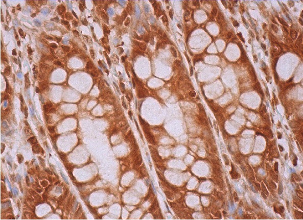 PIG3 (H-300): sc-30068. Immunoperoxidase staining of formalin fixed, paraffin-embedded human rectum tissue showing cytoplasmic and nuclear staining of glandular cells.