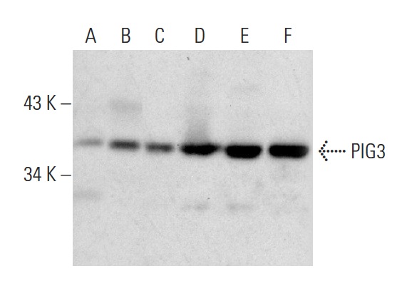 PIG3 (H-300): sc-30068. Western blot analysis of PIG3 expression in A-431 (A), SW480 (B), HeLa (C), Caco-2 (D), A549 (E) and WI-38 (F) whole cell lysates.