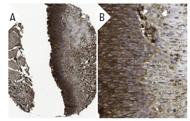 PLC δ1 (H-140): sc-30062. Immunoperoxidase staining of formalin fixed, paraffin-embedded human urinary bladder tissue showing membrane and cytoplasmic staining of surface epithelial cells at low (A) and high (B) magnification. Kindly provided by The Swedish Human Protein Atlas (HPA) program.