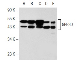 GPR30 (N-15)-R: sc-48525-R. Western blot analysis of GPR30 expression in SK-BR-3 (A), HeLa (B), ZR-75-1 (C), MCF7 (D) and JAR (E) whole cell lysates.