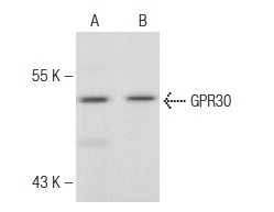 GPR30 (N-15)-R: sc-48525-R. Western blot analysis of GPR30 expression in A-431 whole cell lysate (A) and mouse brain tissue extract (B).