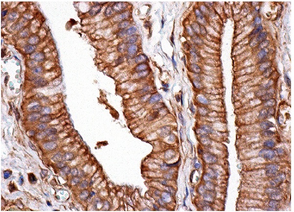 GPR30 (N-15): sc-48525. Immunoperoxidase staining of formalin fixed, paraffin-embedded human gall bladder tissue showing membrane and cytoplasmic staining of glandular cells.