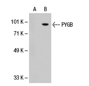 PYGB/L/M (N-20): sc-46347. Western blot analysis of PYGB expression in non-transfected: sc-117752 (A) and human PYGB transfected: sc-113669 (B) 293T whole cell lysates.