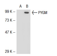 PYGB/L/M (N-20): sc-46347. Western blot analysis of PYGM expression in non-transfected: sc-117752 (A) and mouse PYGM transfected: sc-122855 (B) 293T whole cell lysates.