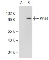 PYGB/L/M (N-20): sc-46347. Western blot analysis of PYGB expression in non-transfected: sc-117752 (A) and human PYGB transfected: sc-170275 (B) 293T whole cell lysates.
