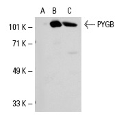 PYGB/M (10H5): sc-51922. Western blot analysis of PYGB expression in non-transfected 293: sc-110760 (A), human PYGB transfected 293: sc-111195 (B) and Hep G2 (C) whole cell lysates.