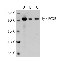 PYGB/M (10H5): sc-51922. Western blot analysis of PYGB expression in human PYGB transfected 293: sc-111195 (A), non-transfected 293: sc-110760 (B) and Hep G2 (C) whole cell lysates.